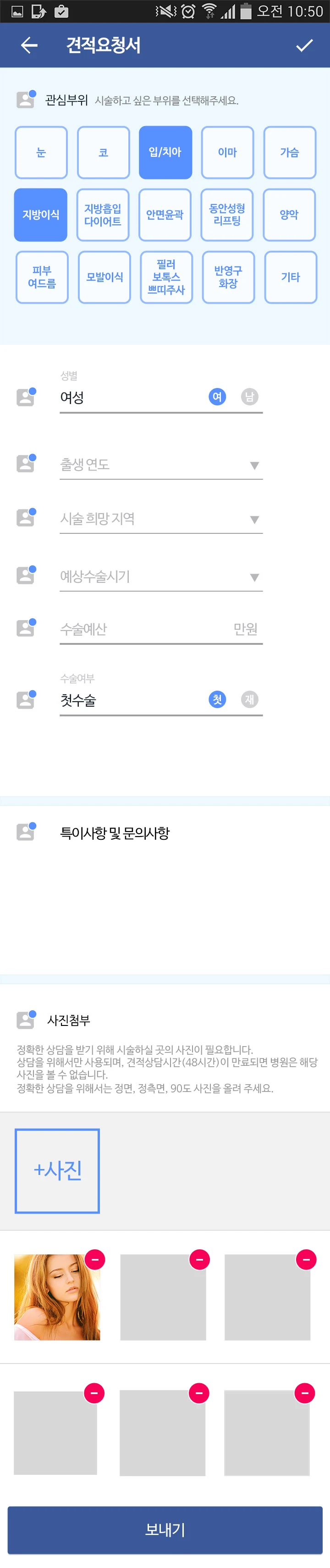관심 부위, 성별, 지역, 수술 시기, 예산을 고르는 견적 요청서 화면